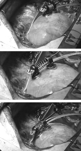 Figure 5. A time sequence of photographs showing the first HeartLander prototype crossing the surface of an exposed beating porcine heart with excised pericardium. [Color version available online]