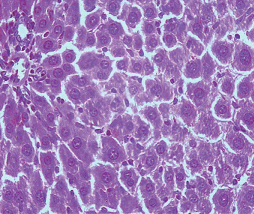 Figure 5.  Microphotograph of liver sections taken from rats of M. alba root bark treated group (50 mg/kg, i.p.). H and E staining (× 400).