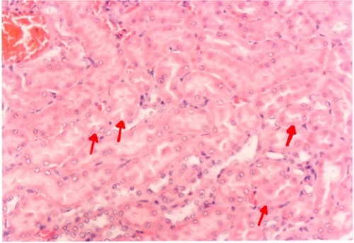 Figure 11 A photomicrograph of the kidney of an Arabic gum- and mercury-treated rat. The red arrows showing insignificant tubular epithelial changes in the form of cloudy swelling, ×200 magnification.