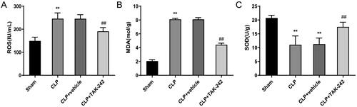 Figure 3. TAK-242 reduces the level of oxidative stress in kidney of septic rats. (A–C) Detection of ROS (A), MDA (B),SOD (C) levels in kidney tissues of rats in the Sham group, CLP group, CLP + vehicle group, and CLP + TAK-242 group. **p < 0.01, vs. Sham group; ##p < 0.01, vs. CLP + vehicle group. ROS: reactive oxygen species; MDA: malondialdehyde; SOD: superoxide dismutase.