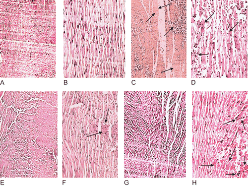 Figure 4.  Photomicrograph of heart showing normal architecture with well-preserved cytoplasm and absence of inflammatory cells and edema at 10× (A) and 40× (B); diabetic control heart shows marked infiltration of inflammatory cells, edema and necrosis (light stained portion) as marked by the arrows at 10× (C) and 40× (D); AGE-treated heart the inflammatory cells are markedly decreased and partial recovery of the hearts is observed as marked by the arrows at 10× (F) and 40× (G); tolbutamide-treated heart shows decreased inflammatory cells and congestion as marked by the arrows at 10× (G) and 40× (H).