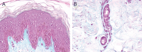Figure 3.  (A) and (B) HF-exposed explants rinsed with Hexafluorine®; aspect at 24 h after a 20-sec exposure. Epidermis (A) and dermis (B). No deterioration of the structures of either the epidermis or dermis was observed.