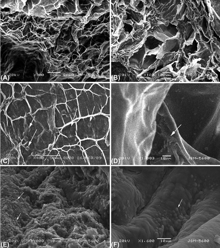 Figure 1. Scanning electron microscope pictures of the high molecular chitosan (500 mg/100 ml) and 5% alginate. A. The surface of the scaffold with a pore size approximately 50–350 μm. B. The cut surface of the scaffold. C. Chondrocytes (arrows) are well attached to the scaffold. D. Chondrocyte attachment (arrow) to the wall of the pores. E. Chondrocytes are covered the entire scaffold surface on the 3rd day of the culture. F. Empty surface areas devoid of chondrocytes are visible on the surface.