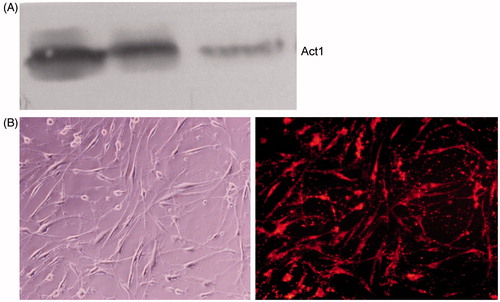 Figure 3. Traf3ip2 siRNA significantly decreased Act1 protein expression level in SW982 cells. (A) Representative Western blot bands of Act1 are shown. Lines 1–2: control-siRNA; line 3: Traf3ip2-siRNA. (B) The DY-547-labeled SW982 cells after transfection with Traf3ip2 gene for 48 h. Left: common microscopy; right: fluorescence microscopy (×400).