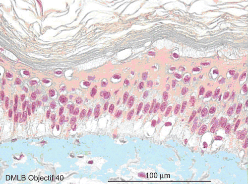Figure 7.  Skin histological aspect at 4 min after a 20-sec exposure to 30 µL of 70% hydrofluoric acid (HF). The same deteriorations in the epidermis were observed compared with those described at 3 min. In the papillary dermis, cells more clearly showed pyknotic nuclei, but the reticular dermis remained normal.