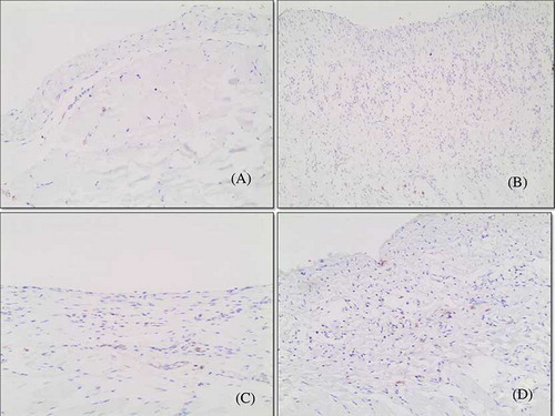 Figure 4.  Immunohistochemical staining for transforming growth factor-β1 (TGF-β1). Histologic sections from (A) the control group, (B) CG group, (C) resting group, and (D) CG + IMA group (magnification ×200).