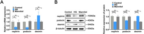 Figure 1. Construction of the podocyte injury model. (A) RT-qPCR was used to measure the mRNA expression levels of nephrin, podocin and desmin in mouse podocytes in the control, HG, and mannitol groups. (B) Protein expression levels of related indexes in cells were assessed by western blotting. The data are expressed as the mean ± SD. *p < .05, ***p < .001 vs. the control group. NS: not significant; HG: high glucose; RT-qPCR: real-time quantitative polymerase chain reaction.
