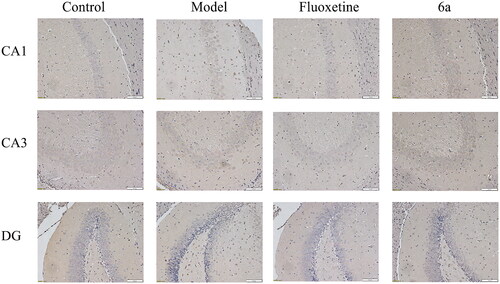 Figure 11. Effects of compound 6a and fluoxetine on 5-HT1AR expression in the hippocampus of CUMS mice. original magnification ×200, scale bar 100 μm.