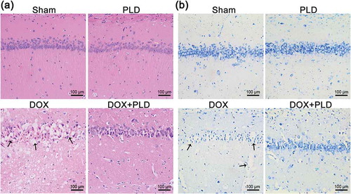 Figure 2. PLD alleviated neurodegeneration induced by DOX. (a) Histological sections of hippocampus were observed by HE staining (magnification, ×200). Black arrows indicated nuclear pyknosis and degeneration in the DOX group. (b) Histological sections of the hippocampus were observed by toluidine blue staining (magnification, ×200). Black arrows indicated the degenerated neurons possessing pyknotic nuclei in the DOX group.