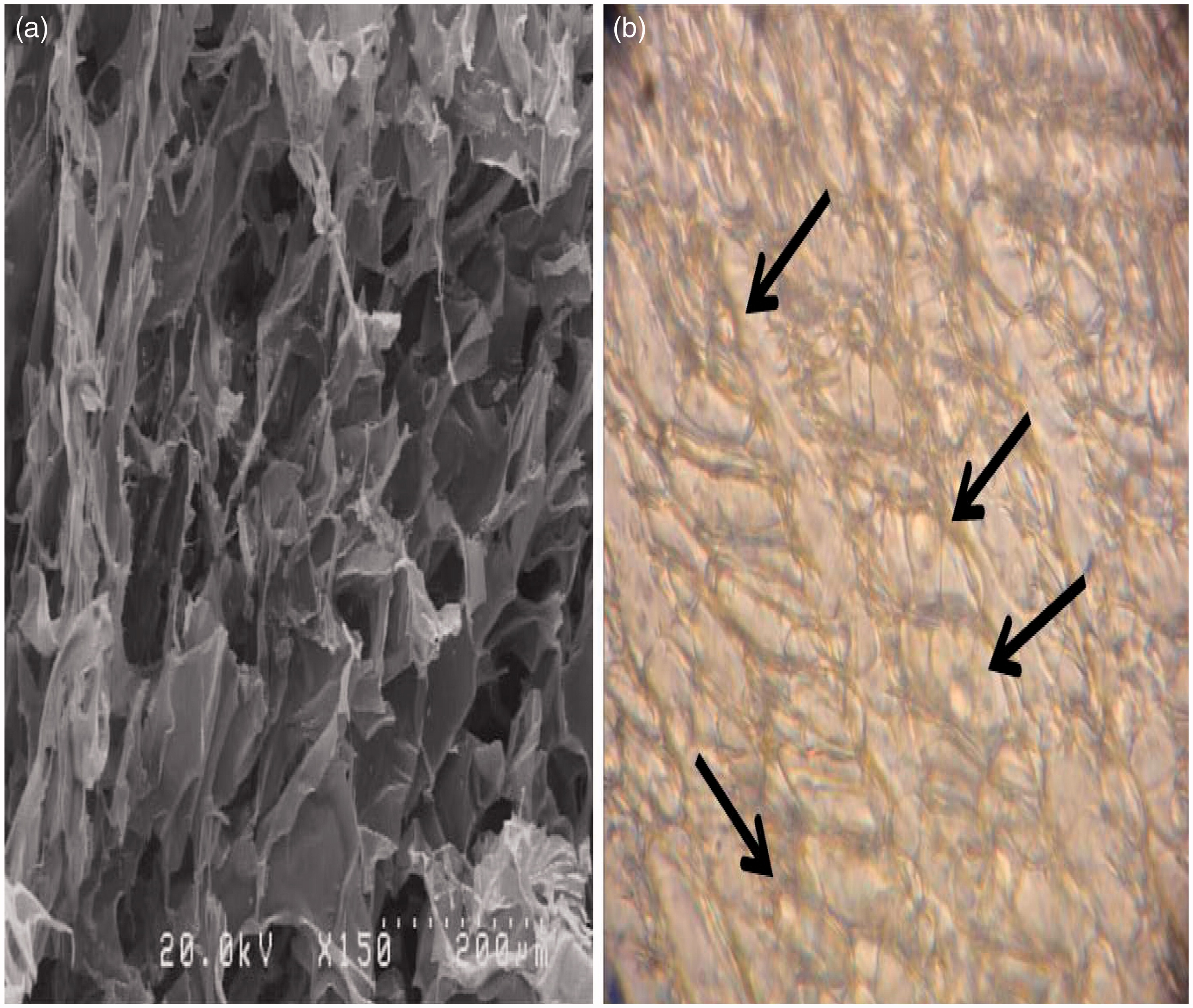 Figure 1. Porous chitosan-collagen scaffold structure. (a) SEM photograph. (b) Cultured DC integration into scaffold pores (under light microscope; 40× magnification).