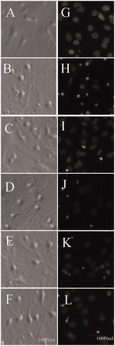 Figure 4. Effects of OSC on morphological changes of OGD/RP injured primary hippocampal neurons. Cellular morphological changes were examined using Olympus optics (Olympus, Tokyo, Japan) (A–F, ×400). Nuclei were labeled with Hoechst 33342 (G–L, ×400). Representative photomicrographs showing damage of neurites and denote chromatin condensation of hippocampal neurons. (A, G) Control; (B, H) exposure to OGD/RP; (C, I) treated with Nim (12 μmol/L); (D, J) treated with low concentration of OSC (1 μmol/L); (E, K) treated with a middle concentration of OSC (2 μmol/L); (F, L) treated with a high concentration of OSC (5 μmol/L).