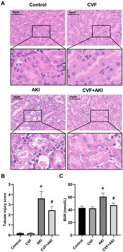 Figure 1. Complement depletion via CVF attenuates nephrotoxicity induced by wasp venom in mice.(A) Pathological changes in the kidney of mice in the control, CVF, AKI, and CVF + AKI groups. All images were acquired from HE-stained sections (Scale bar: 50 μm). (B) Tubular injury score in four groups. (C) Renal function was assessed using BUN in all groups. All analyses of the data were presented as means and standard deviations. *p < 0.05 versus control or CVF group, #p < 0.05 versus AKI group.