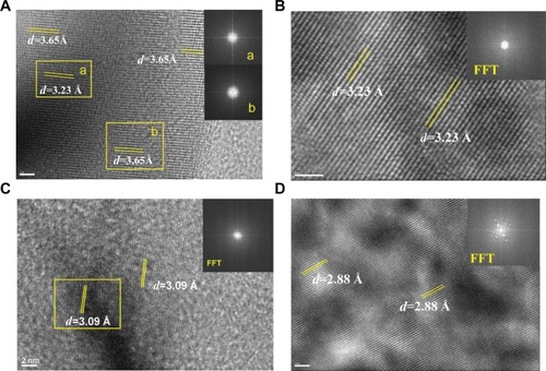 Figure 3 Fast Fourier transformation (FFT) images of high-resolution transmission electron microscopy in different areas of urinary nanocrystallites in one representative calcium oxalate stone patient.Notes: (A–D) show patients A–D, respectively. a and b show the FFT diffraction patterns transformed from the respective yellow boxes in A.Abbreviation: d, interplanar spacing.