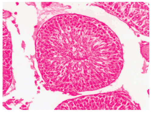 Figure 5.  Showing the section of Rat testis treated with Myristica fragrans Oil at the dose level of 0.5 ml/kg b. wt. for 60 days.