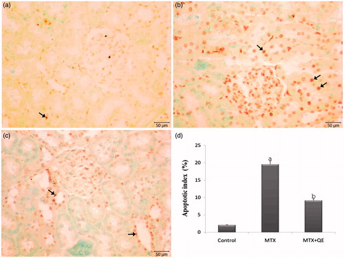 Figure 2. TUNEL staining of renal cortical tissues in different groups. (a) In control group, a few TUNEL positive cells were observed in the renal cortical tissues. (b) The TUNEL positive cells were significantly higher in the renal cortical tissues of the MTX treated group. (c) QE treatment markedly decreased the number of TUNEL positive cells. (d) The apoptotic index was significantly decreased in the MTX+QE group when compared to MTX group. (Arrow: TUNEL positive cells), (TUNEL, scale bar, 50 μm). ap < 0.001 compared to control group, bp < 0.01 compared to MTX group.