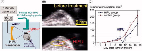Figure 8. (A) Diagram of the experimental set-up for boiling histotripsy of subcutaneous B16 melanoma tumours in mice. (B) Frames of B-mode ultrasound recorded before and during boiling histotripsy treatment of the tumour. (C) The dynamics of the tumour growth before and after boiling histotripsy or sham treatment (n = 4 per group). Although the treatment delayed the tumour growth, it did not affect the subsequent tumour growth rate.