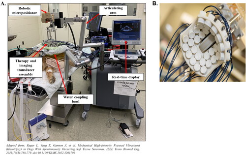 Figure 2. Experimental histotripsy set-up. A) a robotic micro-positioner is connected to an articulating arm supporting the therapy and imaging transducer assembly. The transducer assembly was submerged in a water coupling bowl coupled to the patient’s tumor, and treatment was monitored in real-time using ultrasound imaging. B) The 500 kHZ histotripsy transducer with coaxially aligned ultrasound imaging probe utilized for OS and STS extremity tumor ablation in canine patients.