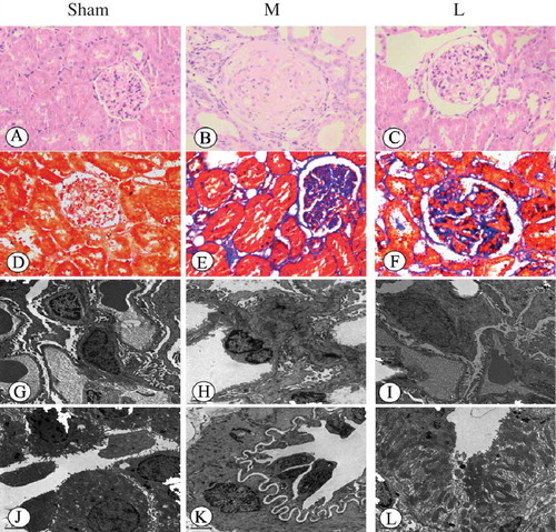 Figure 2. Histopathological changes in rat renal tissue samples at 12th week (HE, Hematoxylin–eosin staining ×200; Masson, Masson staining ×200; EM, electron microscopy ×5000); (A) There was no significant histological abnormality in the sham group (HE); (B) glomerular sclerosis, renal tubular epithelial cell degeneration and necrosis, partial tubular atrophy, and some degree of interstitial fibrosis could be seen (HE); (C) in the losartan group, only local mild glomerular and tubular epithelial lesions were observed (HE); (D) there was no fibrosis of the interstitium in the sham group (Masson); (E) glomerular sclerosis with moderate fibrosis of the interstitium was seen in the model group (Masson); (F) a less severe renal fibrosis was observed in the losartan group (Masson); (G) the ultrastructure of intact glomerulus was seen in the sham group (EM); (H) an bending and thickening of the glomerular basement membrane, and podocytes swelling with fusion and flattening of part of the foot processes were found in the model group (EM); (I) less severe damages of the glomerular basement membrane and podocytes were observed in the losartan group (EM); (J) the normal tubule epithelial cells and basement membrane were seen in the control group (EM); (K) in the model group, tubular swelling and degeneration were found with significant interstitial fibroblast proliferation (EM); (L) a Less severe tubulointerstitial damage was observed in the losartan group (EM). Sham: sham-operation group, M: model group, L: losartan group.