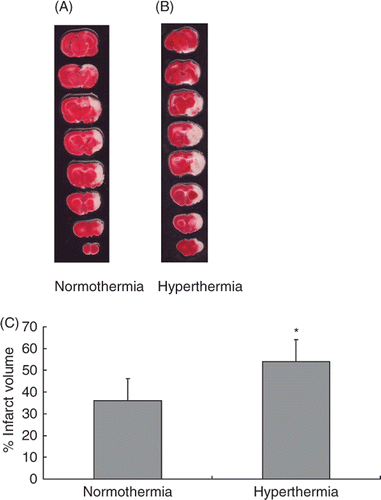 Figure 1. Hyperthermia enlarged the infarct in an embolic model of ischaemic brain injury. Representative TTC-stained brain sections from normothermic (A) and hyperthermic (B) rats, sacrificed at 24 h after the MCA occlusion. The infarct volume was measured in the TTC stained brain sections at 24 h after MCA occlusion (C). *p < 0.01 compared with the normothermic group.