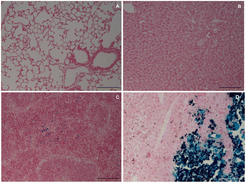 Figure 5. Perls’ staining of lung (A), liver (B), spleen (C) and tumour (D) of the treatment group animals. The iron was detected in the spleen and in the tumour, near to FC. Bar = 25 µm.