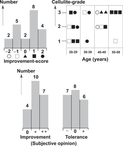 Figure 4 Results: distributions of 21 female test persons. Upper left: histogram for improvement score (see Figure 3, −2 (Display full size): clear worsening, −1 (□): worsening, 0 (▴): no change, +1 (▪): improvement, +2 (•): clear improvement) from collagenometry (Figure 3). Upper right: improvement score as function of age and cellulite-grade. Lower left: histogram for subjective opinion 0: no improvement, +: little improvement, ++: good improvement (smoothening of skin and more stretched). Lower right: histogram for low energy defocused ESWT tolerance −: negative tolerance (not suitable, some pain), 0: indifferent, +: tolerance positive tolerance (suitable, no pain).