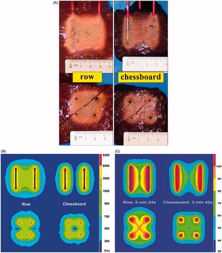 Figure 7. (A) Ex vivo bovine liver experiments: influence of electrode pattern on ablation zone in axial and transverse plane. (B) FEM modelling with RAFEM-2: influence of pattern on electric field (V/m) in axial and transverse plane. (C) FEM modelling with RAFEM-2: influence of pattern on temperature (°C) in axial and transverse plane at current shut-off: 5 min 24 s for row pattern and 3 min 42 s for chessboard pattern.