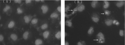 Figure 6.  Effects of schisandrin C on the nuclear morphology in Bel-7402 cells. Fluorescent staining of nuclei in schisandrin C-treated Bel-7402 cells by Hoechst 33258. Cells were treated with 75 μ M schisandrin C for 24 h. Cells with condensed and fragmented nuclei and apoptotic bodies (arrows) are seen in the schisandrin C-treated cells (B), but not in the control treatment (A). Magnification x 200.
