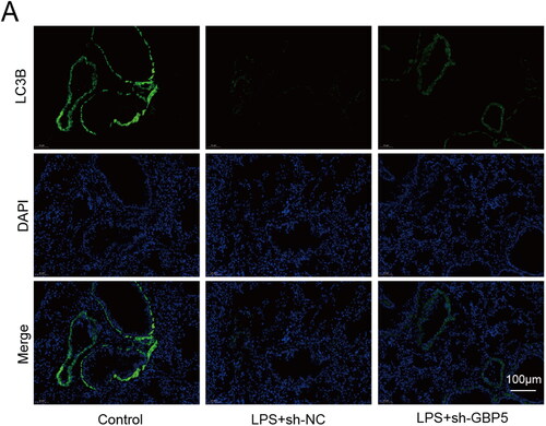 Figure 3. Decreasing GBP5 expression increased autophagy that LPS suppressed in ARDS mice.(A) Representative immunofluorescence images showing LC3B for the Control, LPS + sh-NC, and LPS + sh-GBP5 groups.