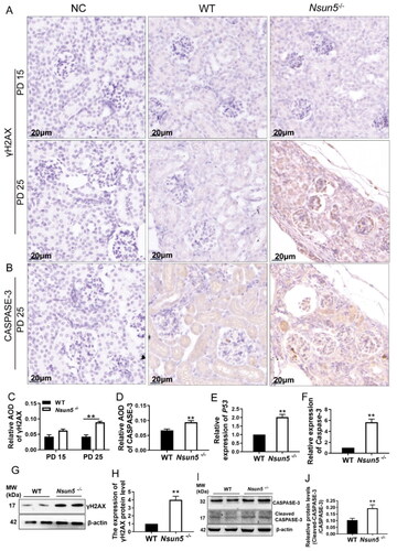 Figure 5. Nsun5-/- mice exhibited high expression of apoptosis signal and DNA damage in the kidneys.(A) Immunohistochemistry showed that the staining intensity of the γH2AX positive cells is increased in the kidney Nsun5-/- mice compared to WT at PD 25 not PD 15. Scale bar: 20μm. (B) Immunohistochemistry showed that the staining intensity of the CASPASE-3 positive signal is increased in the kidney of Nsun5-/- mice compared to WT at PD 25. (C-D) Average optical density (AOD) was used for the quantitative analysis of immunohistochemistry staining, and the data are shown in bar graphs. (E-F) The mRNA expression levels of P53 (E) and Caspase-3 (F) in the kidney of Nsun5-/- mice were higher than those in WT mice (n = 6-8 per genotype). (G) Results of Western blotting showed that the protein level of γH2AX was increased in the kidney Nsun5-/- mice compared to those in WT. (H) The results of Western blotting were quantified and displayed in bar graphs. The values are given as mean ± SEM analyzed using Student’s t-test. * P < 0.05, ** P < 0.01 (I) Results of Western blotting showed that the protein level of CASPASE-3 was increased in the kidney of Nsun5-/- mice compared to those in WT. (J) The results of Western blotting were quantified and displayed in bar graphs. The values are given as mean ± SEM analyzed using Student’s t-test. * p < 0.05, ** p < 0.01.