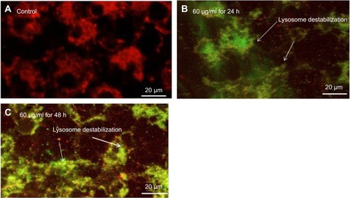 Figure 8 Images representing lysosome destabilization in HaCaT cells after exposure to yttria-stabilized zirconia nanoparticles (60 μg/mL) for 24 and 48 hrs. (A) Control cells; (B) 60 µg/mL for 24 hrs; (C) 60 µg/mL for 48 hrs.