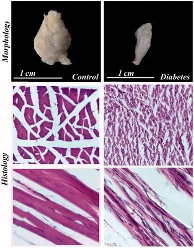 Figure 8. Morphology and histology of BS in control and diabetes. The BS muscle shows severe degenerative changes in diabetic rat. Figure showing transverse and longitudinal sections of muscle. H & E 40×.