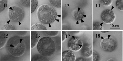 Figs 11–18. Vegetative cells of Eudorina and Yamagoshiella showing two types of distribution of contractile vacuoles in the protoplasts. Figs 11–14. Eudorina. Note each cell has several contractile vacuoles (arrowheads) distributed in the protoplast surface. Figs 11, 13 give surface views of protoplasts and Figs 12, 14 provide optical sections. Figs 11, 12. E. unicocca NIES-724 (UTEX 737, 1m). Fig. 13. E. peripheralis NIES-725 (UTEX 1215, 93f). Fig. 14. E. illinoisensis NIES-723. Figs 15–18. Yamagishiella unicocca. Note only two anterior contractile vacuoles (arrowheads) in the protoplast surface. Figs 15, 17, 18 are surface views of anterior regions of protoplasts and Fig. 16 an optical section of the protoplast. No contractile vacuoles are visible in the periphery. Figs 15, 16. Hasu-2. Fig. 17. NIES-762. Fig. 18. NIES-870.