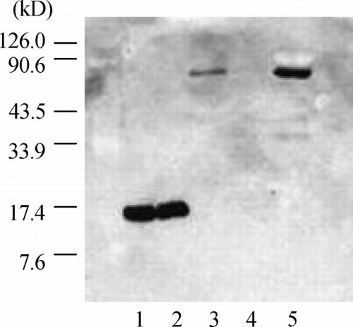 Figure 2. Western blot analysis of the eluted phospholipase A2 (PLA2) using anti‐human group IIA PLA2 monoclonal antibody. The purified IIA PLA2 (lane 1) and purified PLA2 including 1 mg/mL heparin (lane 2) were identified as one approximately 14 kD band, and the PLA2 in eluting solution (H‐1) (lane 3) was identified as an approximately 70 kD band. There was no band in washing solution (F‐10) (lane 4). The PLA2 in the ultradiafiltrate was identified as an approximately 70 kD band (lane 5).