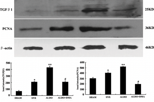 Figure 6.  The expression of TGFβ1 and PCNA in renal cortical tissues by Western blot. TGFβ1 and PCNA in renal cortical tissues were markedly increased in rats that received aldosterone infusion, indicating ECM accumulation and cell proliferation in the kidney. The aldosterone-induced increase in renal cortical TGFβ1 and PCNA was prevented by treatment with DMA. Data are expressed as the relative differences between SNX rats and ALDO or ALDO+DMA treated rats after normalization to β-actin expression. *p < 0.01 versus SHAM group; **p < 0.01 versus SNX group; #p < 0.05 versus ALDO group.