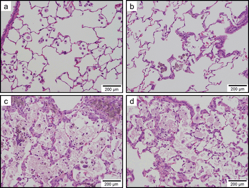Figure 9.  Light micrographs of lung tissue sections of rats at 3 months after instillation in experiment 1 (H&E stain). No significant changes were observed in the vehicle control group (panel a). Minimal macrophage accumulation was observed in the alveoli of the 0.2 mg/kg SWCNT-exposed group (panel b). Moderate macrophage accumulation accompanied with foamy macrophages, mild inflammatory cell infiltration in the alveoli, mild macrophage infiltration and granuloma in the interstitium, and mild hypertrophy of alveolar epithelium were observed in the 2.0 mg/kg SWCNT-exposed group (panel c). Mild macrophage accumulation accompanied with foamy macrophages, minimal inflammatory cell infiltration in the alveoli, and minimal hypertrophy of alveolar epithelium were observed in the crystalline silica-exposed group (panel d).