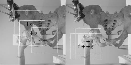 Figure 3. Left Fluoroscopic imaging centers of the pelvis for CT-3D fluoroscopy matching were the pubic symphysis (a), the acetabular fossa (b), and a site on the ilium 3 cm above the acetabular roof (c) (the imaging centers are indicated with crosshairs). Right: Fluoroscopic imaging centers of the proximal femur for CT-3D fluoroscopy matching were the base of the femoral neck (d), the femoral shaft at the level of the lesser trochanter (e), and the inferior border of the great trochanter (f).