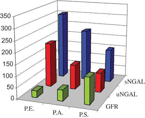 Figure 1. sNGAL, uNGAL, and GFR in patients studied. It can be seen that there is a different renal impairment, given the three different values of GFR obtained using renal scintigraphy. The values of the NGAL present a different trend in the three cases and reflect, in inverse way, the renal injury. In fact, P.E. has the highest values of NGAL, due to the most severe renal impairment evidenced by the lower value of GFR.Note: NGAL, neutrophil gelatinase-associated lipocalin; GFR, glomerular filtration rate.