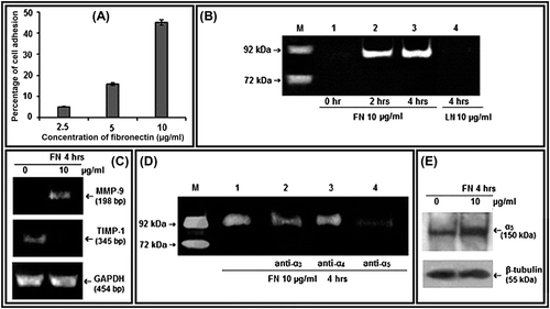 Figure 1. Effect of FN on MMP-9, TIMP-1, and α5 integrin in PC-3 cells: A. Cell-adhesion assay was done with different concentrations (2.5, 5, and 10 μg/ml) of FN and percentages of adhesion were plotted. B. PC-3 cells were grown in SFCM in absence (Lane 1) and in presence of 10 μg/ml of FN for 2 h (Lane 2), for 4 h (Lane 3), and 10 μg/ml of LN for 4 h (Lane 4). Culture supernatant of HT-1080 cells grown in SFCM for 24 h was used as MMP-9 (92 kDa)/MMP-2 (72 kDa) marker (Lane -M). The culture supernatants in all the cases were subjected to gelatin zymography. C. PC-3 cells were grown in serum-free culture medium (SFCM) in absence (0) and in presence of 10 μg/ml FN for 4 h. 2 steps RT-PCR was done with equal amounts of total RNA, using MMP-9 and TIMP-1 specific primers for PCR. GAPDH primers were used to confirm equal loading. D. PC-3 cells were treated without (Lane 1) or with 1 μg/ml anti- α3 (Lane 2), anti-α4 (Lane 3), and anti-α5 (Lane 4) integrin antibodies for 1 h and then all the sets were grown in presence of 10 μg/ml FN for 4 h. Gelatin zymography of the culture supernatants were performed. E. Following FN treatment (10 μg/ml for 4 h), PC-3 cells were collected, extracted, and equal amounts of protein (100 μg) was subjected to western blot analysis with anti-α5 antibody (1 μg/2 ml dilution) and respective HRP-coupled secondary antibody (1 μg/200 ml dilution) for ECL method. β-tubulin was used as internal control.