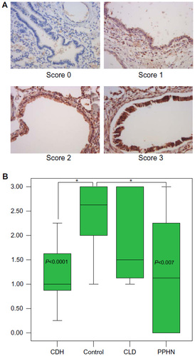Figure 1 The NGF representative slide-staining (×400) scores (0–3) (A) and the corresponding intensity staining scores (B) at the bronchiole level.