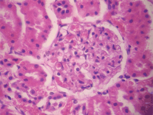 Figure 4.  Histopathologic presentation of male rat kidney of CF 80 mg/kg group (Congested; 400×).