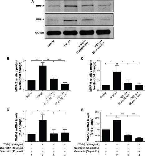 Figure 5 Quercetin suppressed TGF-β1-induced MMP expression in RPE cells.