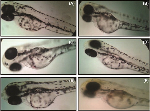 Figure 8. Sodium-selenite-treated zebrafish embryo. (A) Control; (B) 5 μg/ml of sodium selenite; (C) 10 μg/ml of sodium selenite; (D) 15 μg/ml of sodium selenite; (E) 20 μg/ml of sodium selenite; (F) 25 μg/ml of sodium selenite.