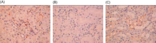 Figure 6. BMP-7 expression in rat renal tissue at week 21 (×250). (A) BMP-7 was largely expressed in the renal tubular epithelial cells and renal interstitium, especially in the medulla area in the control group. (B) A decreased BMP-7 expression was found in the renal tubular epithelial cells and renal interstitium. (C) BMP-7 expression in the renal tissue was significantly increased in Cozaar group.