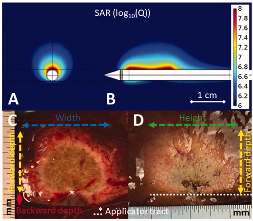 Figure 2. Simulated directional applicator microwave specific absorption rate (SAR) cross-sectional (A) and longitudinal (B) plots above images of DMWA experiments in ex vivo liver (C,D). The cross-sectional image (C) shows the applicator tract, forward ablation depth (df) (yellow dashed line), backward ablation depth (db) (red line), and ablation width (w) (blue dashed line) while the longitudinal image (D) shows forward ablation depth (df) (yellow dashed line) and ablation height (h) (green dashed line).