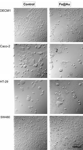 Figure 2 The bright-field optical images show the morphology of Fe@Au-treated cells.Notes: Except for a different cell density, the CRC and OECM1 cells show no significant alteration in overall morphology after 24 hours of Fe@Au exposure. All images were recorded at the same magnification. Scale bar, 100 μm.Abbreviations: CRC, colorectal cancer; Fe, iron; Au, gold.