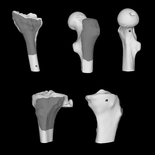 Figure 3. Computer models of the bone surfaces used in the simulations. Dark gray regions are the regions from which registration points may be selected. Targets are marked by the dark gray cubes. On the distal radius model (top left), the target is the approximate location of a screw hole for a plate used to fixate an osteotomy performed to correct a fracture malunion. On the proximal femur model (top center and right), the target is the approximate location of an osteoid osteoma. On the proximal tibia model (bottom), the target is a point on the hinge of a closing wedge osteotomy.