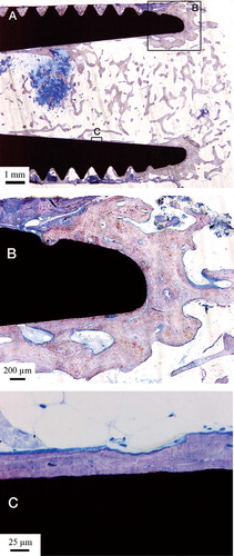 Figure 4. A. Micrograph of the apical part of the implant. Trabecular bone is growing into the hollow apex of the implant and is also growing at the implant surface. B. Bone growth into the hollow part of the implant following the implant surface. C. This high-magnification optical micrograph shows the bone-implant contact in the hollow part of the implant.