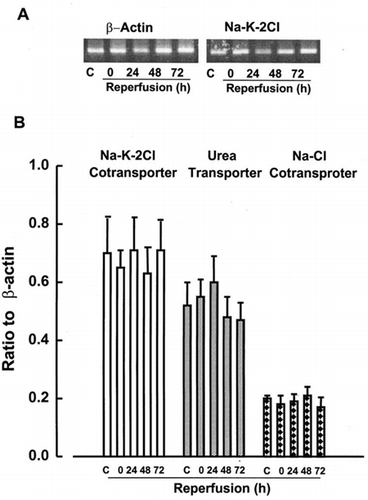 Figure 4. RT-PCR analysis of Na+-K+-2Cl, urea, and NaCl transporters in renal medulla. Transcript levels of these transporters were analyzed in medulla at control kidneys or kidneys subjected to 0 (ischemia), 24, 48, and 72 h of reperfusion following 60 min of ischemia. Data represent ratio to β-actin signals and are mean ± SE of 3 separate experiments.