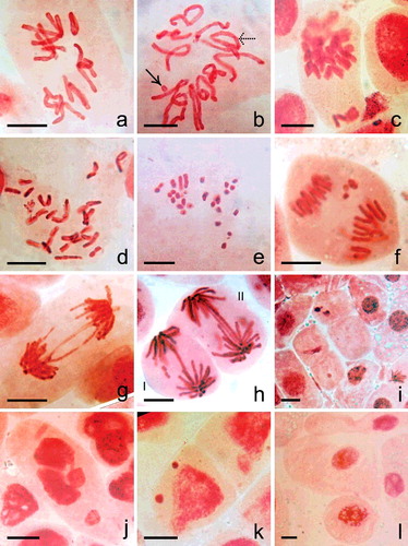 Figure 4. ( a–h) Mitotic cells ((a–e) metaphase, (f–h) anaphase) of N. sativa in (a) control and (b–i) Cu- and CdS-NPs treated material. (a) 2n = 12. (b) Differentially condensed chromosome with a fragment (right-handed arrow) and a ring (dotted arrow). (c) Diplochromatid nature of chromosomes with unoriented chromosomes. (d) Cell with >2n = 12 chromosomes. (e) Differential condensation and fragmentation of chromosomes. (f) Anaphase with lagging fragments. (g) Chromosome bridge formation. (h) I: Anaphasic bridge with two equal size fragment, II: Double bridge with two minute fragments. (i) Cells without or with depleted chromatin. (j) Cell with fragmented chromatin mass. (k) Interphase cell with two unequal sized micronuclei. (l) Giant cell. Scale bar = 20 µm.