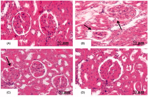 Figure 5. Effect of AEBM on histopathological changes in renal tissue of HCD-induced hypercholesterolemia in control and experimental rats. Transection of renal tissue (control) showed normal architecture of glomeruli and tubules of nephron (H&E, 100×) (Figure 5A). Transection of HCD-induced rats depict swelling of renal tubules and tubular epithelial denudation with casts in the widened lumens (glomerular hypertrophy) of renal tissue (Figure 5B). Transection of AEBM + HCD rats showed mild tubular epithelial damage when compared with HCD rats (Figure 5C), when compared with HCD rats. AEBM alone (Figure 5D)-treated rats showed normal renal architecture similar to that of control rats (H&E, 100×) (scale bar: 50 µm).